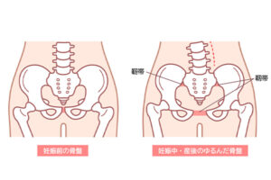 妊娠中の骨盤 骨盤の開き