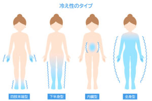 冷え性　タイプ